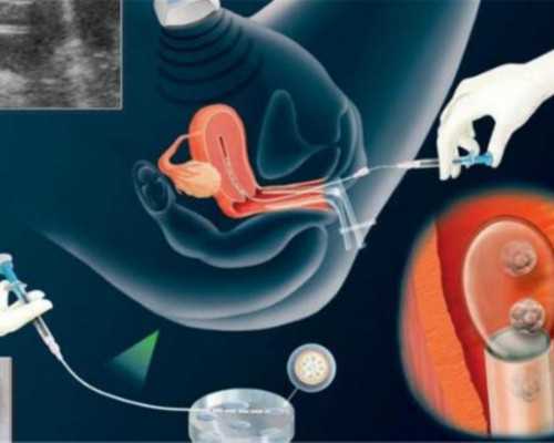 国内供卵广告公司_咨询代孕网电话,
六安怀孕建档综合医院没有妇幼