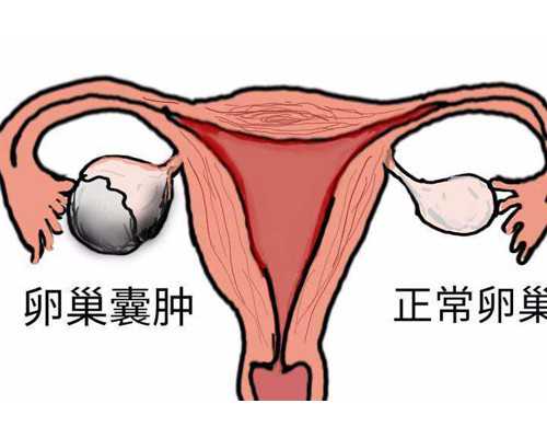 国内代孕咨询电话_代孕网站哪家靠谱,宝宝老流鼻涕