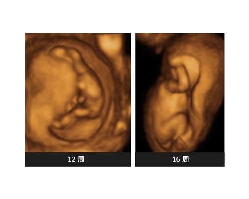 西北妇女儿童医院|西安后宰门西北妇幼医院看不孕不育哪位医生看的好