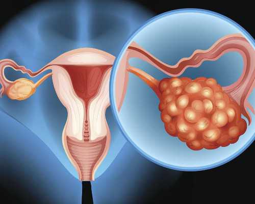 海外辅助生殖咨询_试管包生儿子几率大吗,胚胎移植后是否可以手洗衣服-注意