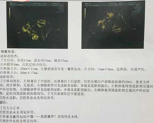 榆林三代试管婴儿机构被骗,附费用详细指南!