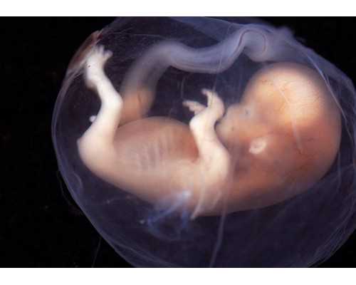 包生男孩费用低_代生包生女儿,"育儿网站"苏州试管孩子多少钱